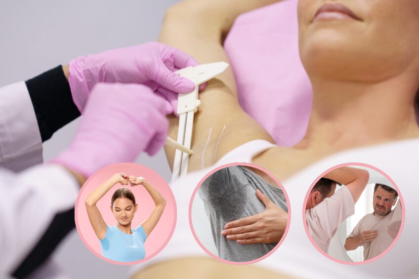 Hyperhidrosis (Excessive Sweating) Treatment